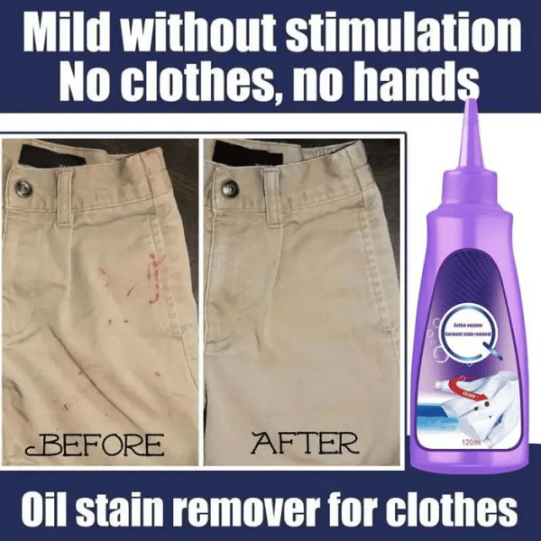 🔥Last Day 49% OFF🔥 Active Enzyme Laundry Stain Remover